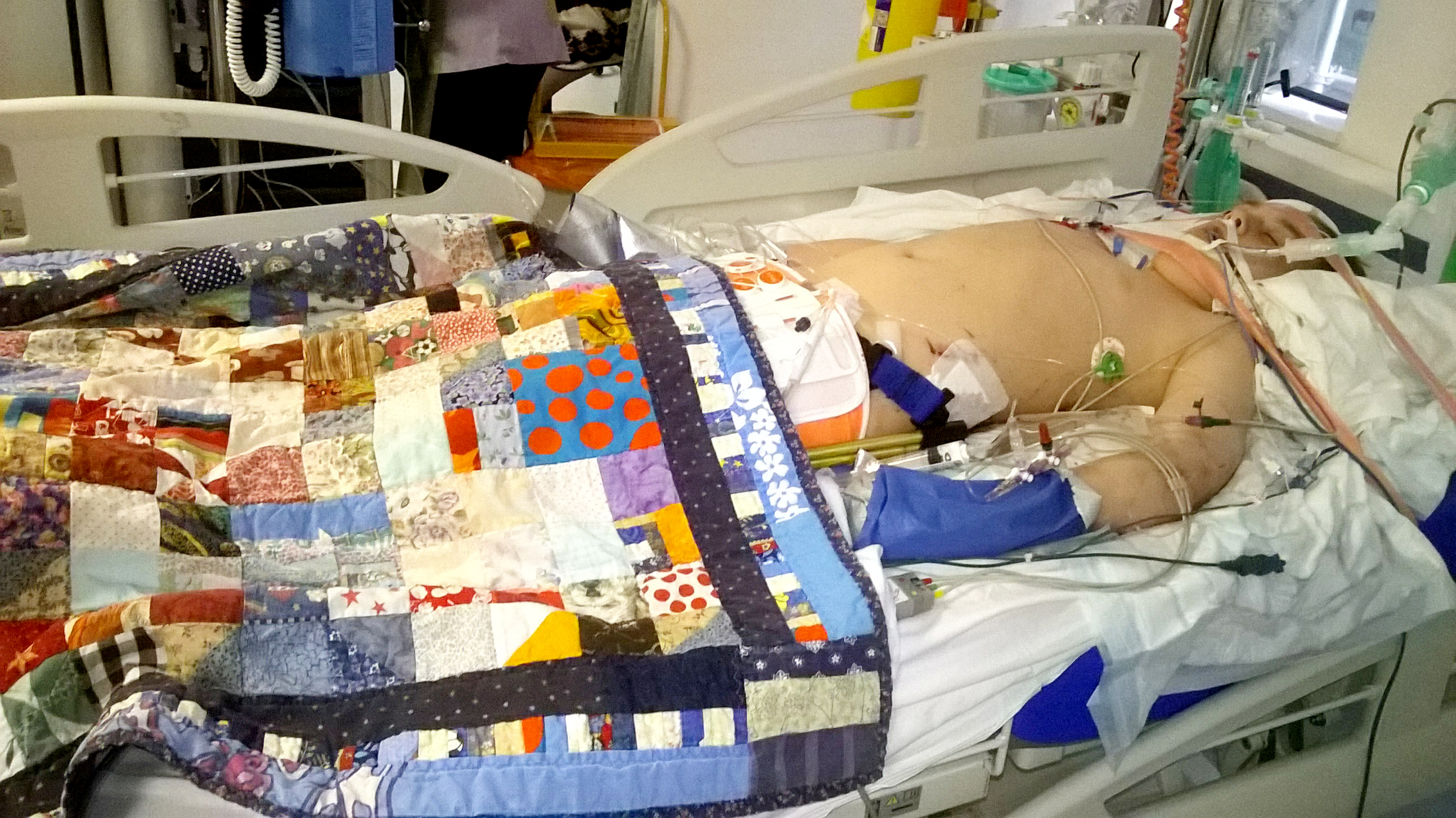 Un tânăr spulberat de o motocicletă a fost readus la viață de medici de patru ori! "Joe n-ar mai fi fost printre noi fără ajutorul lor"