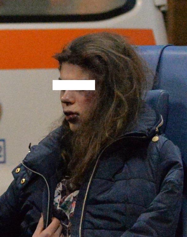 O fată de 14 ani a fost desfigurată de vecinul său! FOTO