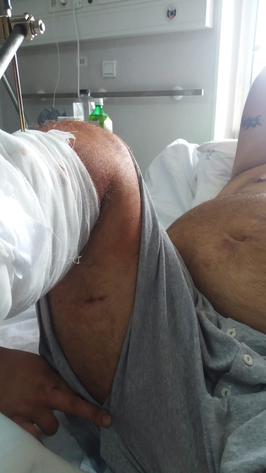 Avocații bătăușului din clanul Chira, care i-a tăiat piciorul rivalului: „Așa-zisa victimă este informatorul polițiștilor și al procurorilor”!﻿