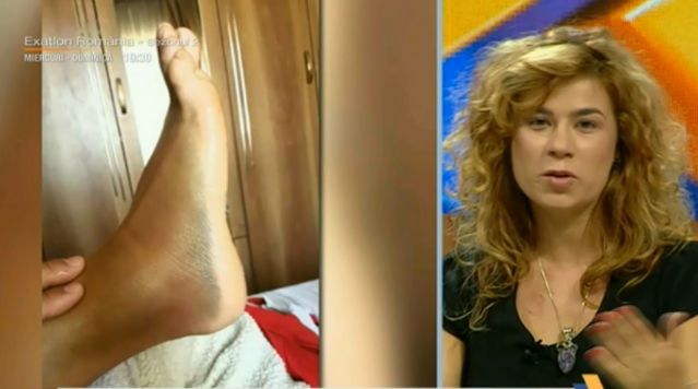 Problemele de sănătate ale Silviei Stroescu, prima eliminată de la Exatlon. "Din păcate, încă nu pot..." | FOTO