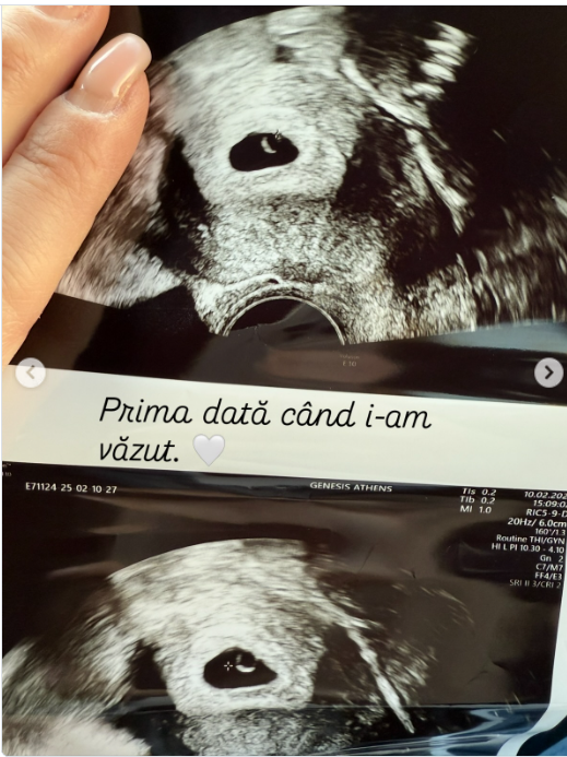 Imagini rare cu gemenii Roxanei Nemeș. Cum a rămas vedeta, de fapt, însărcinată! Acum a spus adevărul. „Fiecare poveste este diferită”