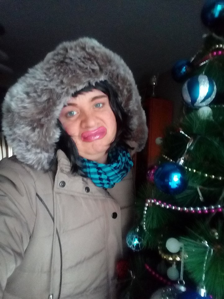 Halucinant cum poate să arate Cristi din Banat. "Mi-am pus silicon de sărbători, nu pot vorbi, nici nu pot mânca" | FOTO