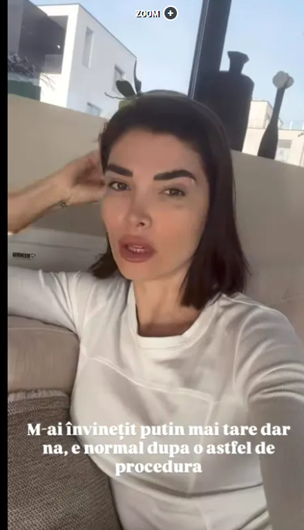 Reacția Alinei Pușcaș după ce a apărut cu vânătăi la ochi. Ce a pățit vedeta. „Mi-e un pic groază, pentru că doare”