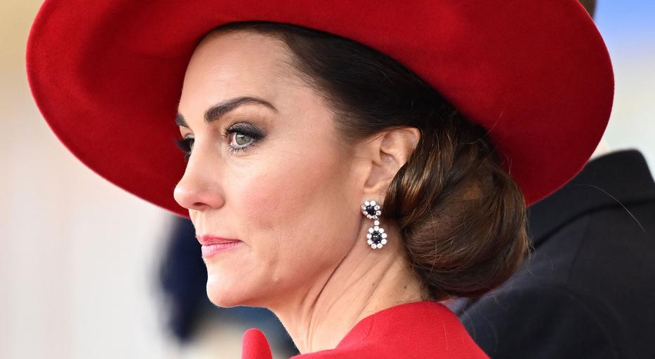 El akarták lopni Katalin hercegné kórlapját a hasi műtétje közben: kiderült, milyen daganata lehet