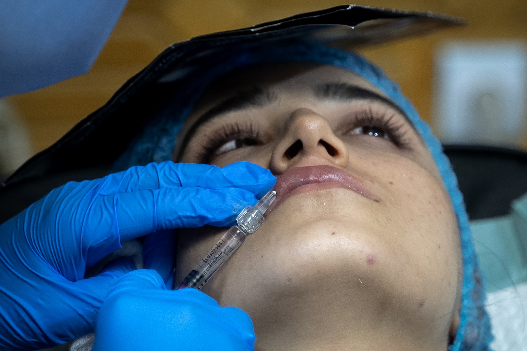 Chirurgia estetică înflorește în secret în Afganistan, sub nasul talibanilor: „Botox pe sub burka. Să fim frumoase în oglindă ne dă energie!”