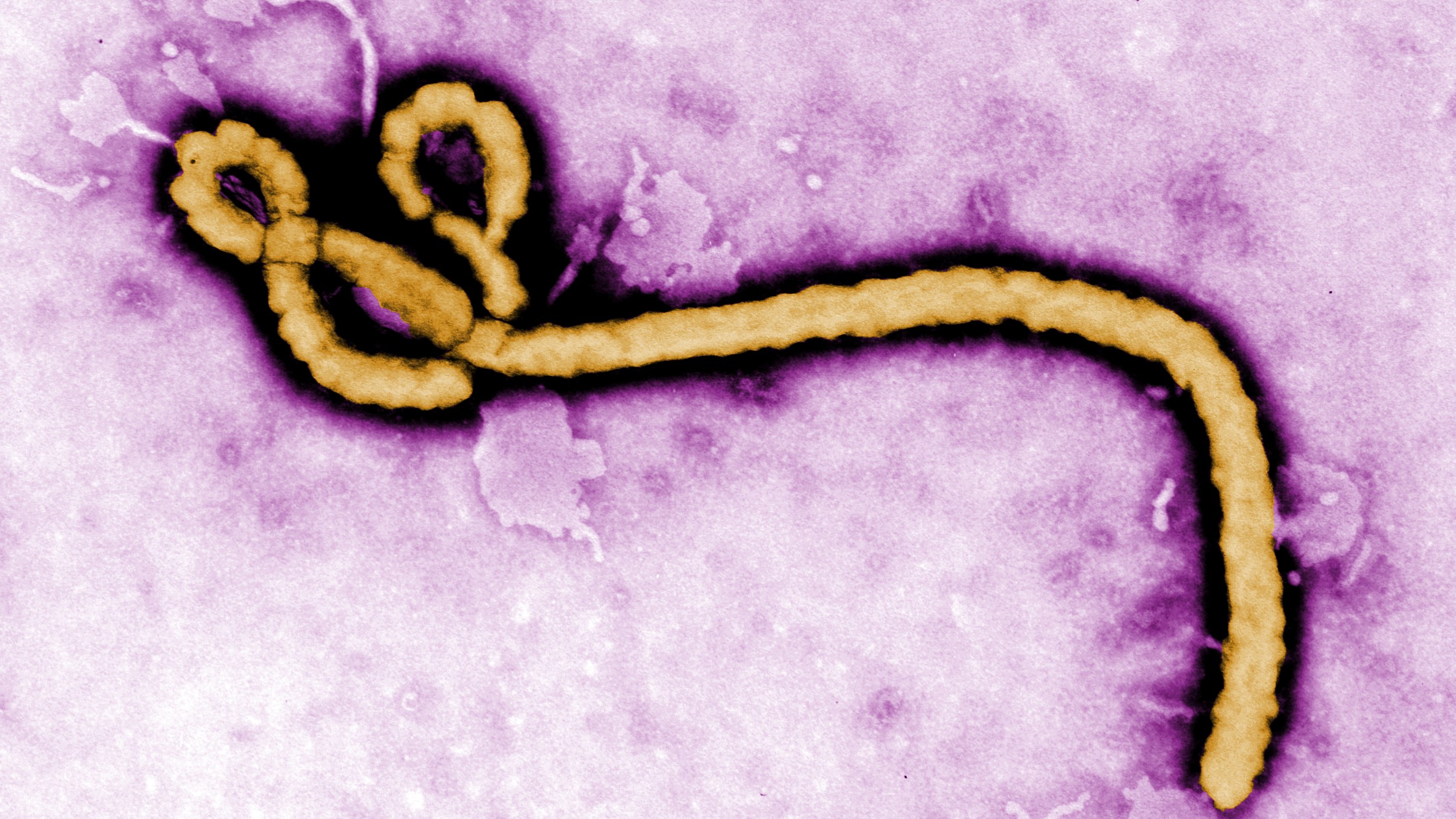 Another African country confirms Ebola case, becoming fifth affected by regional outbreak