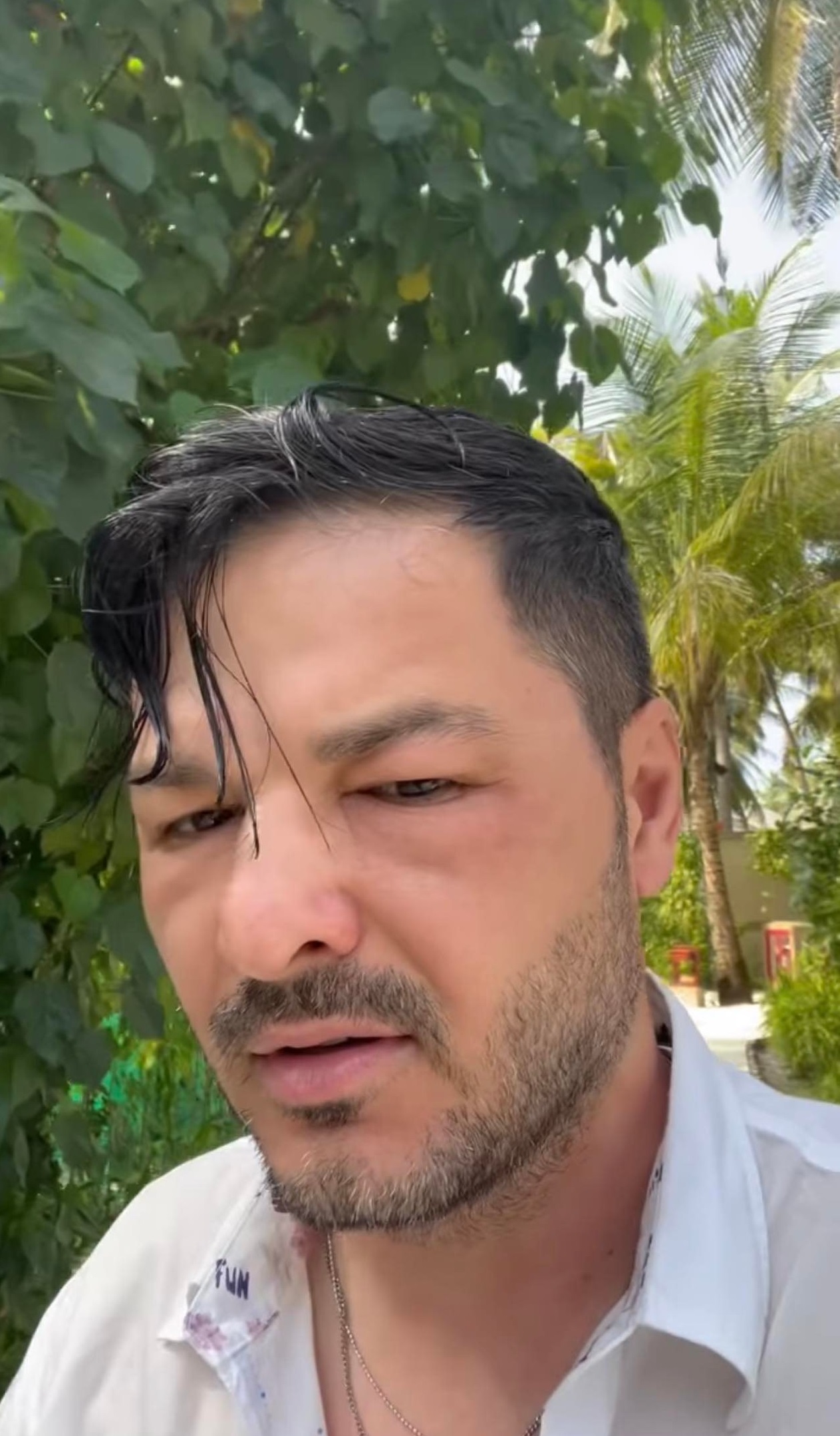 Liviu Vârciu, cu fața umflată în vacanță. Ce a pățit prezentatorul de la Antena 1