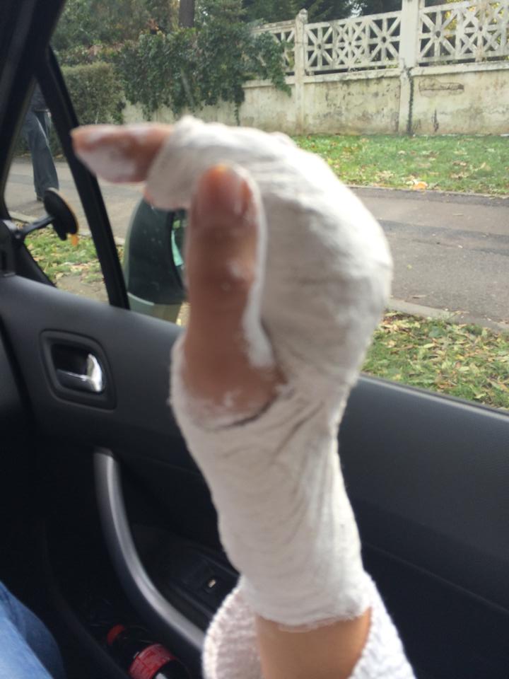 ACCIDENT GROAZNIC pentru o româncă, vicecampioană mondială. I-au căzut 150 kg pe mână