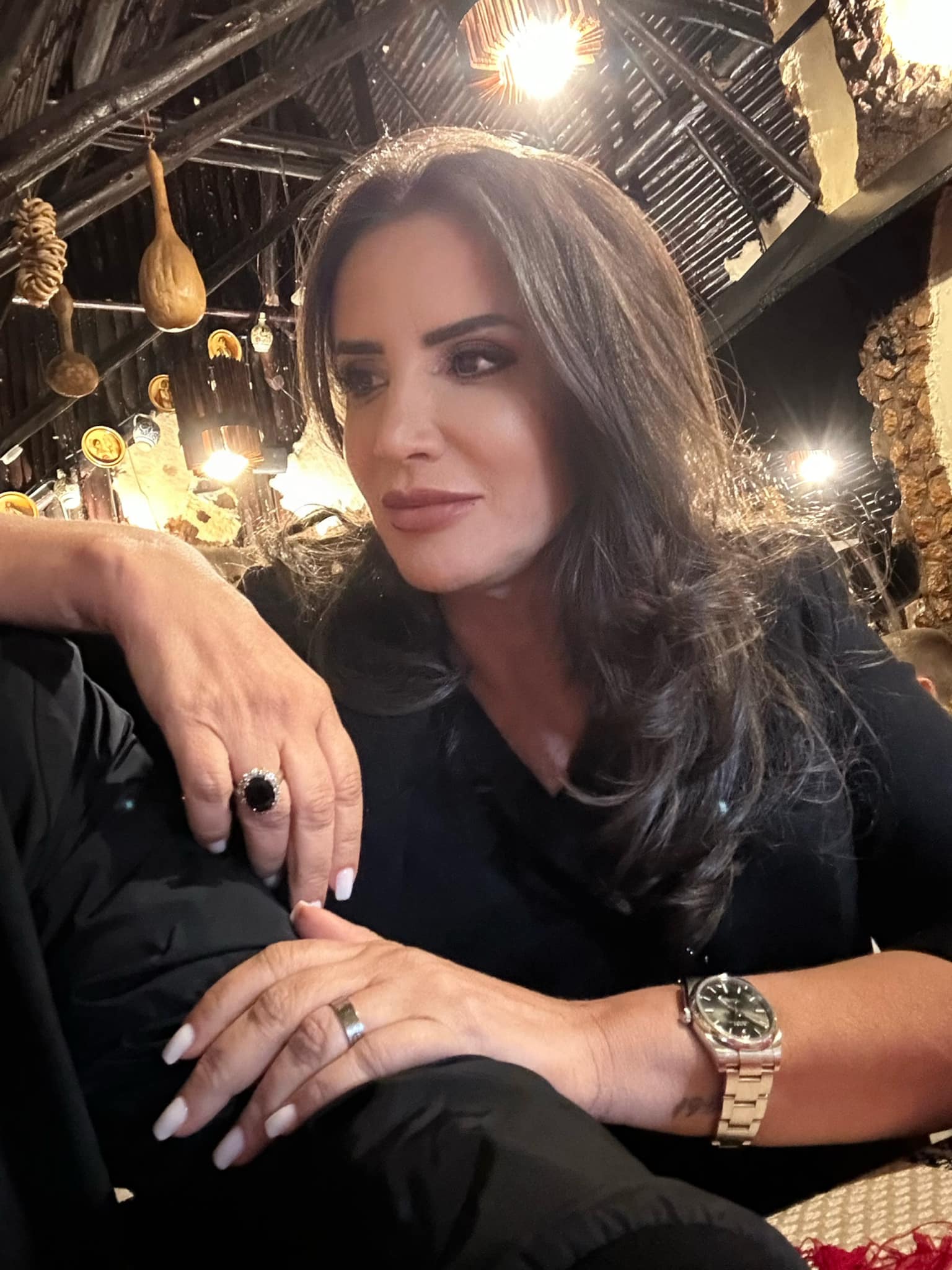 Cum arată Mara Bănică după operația estetică la față, care a costat 15.000 de euro. Fanii au criticat-o: „Nu mai ești tu, nu îți stă bine”