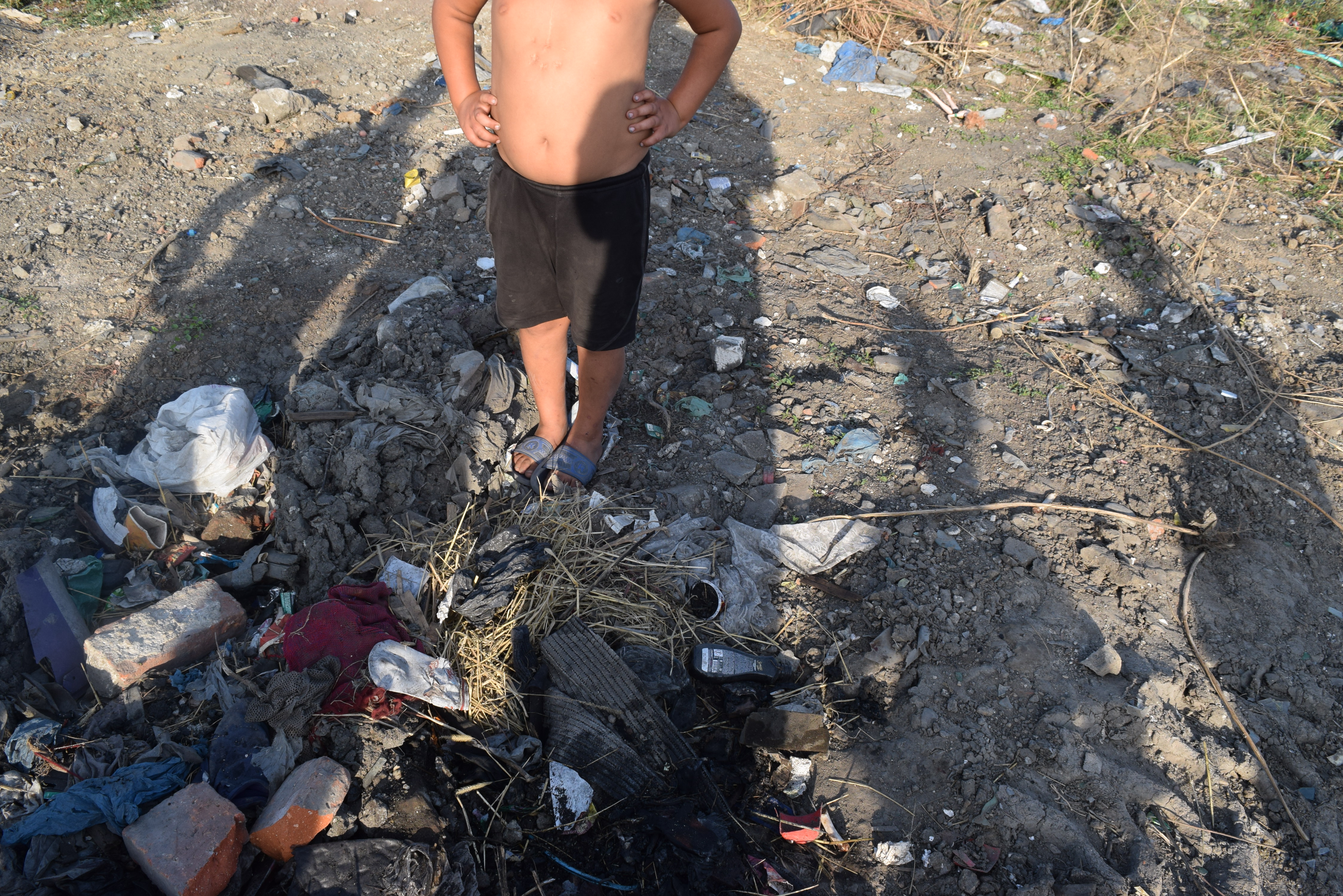 România în 2018, ca acum 100 de ani. Celebrarea tristă a sărăciei noastre în fotografiile făcute de locuitorii din ghetou