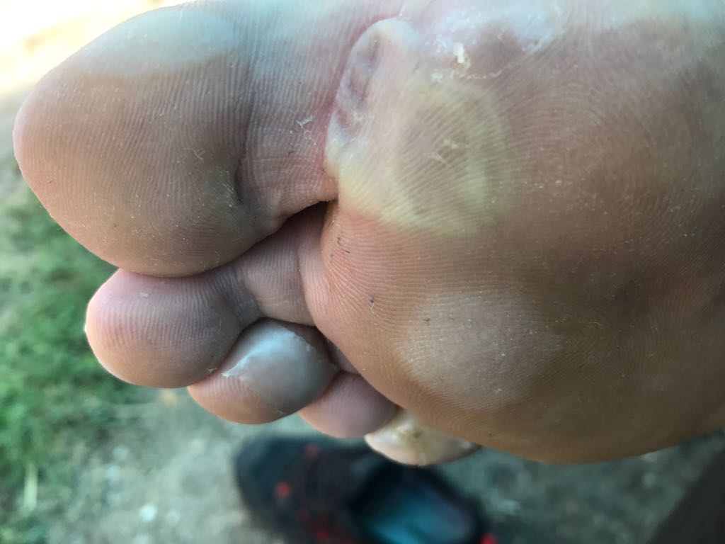 VIDEO/ Primarul care străbate pe jos 320 de kilometri, ca să aducă apă potabilă în localitatea sa. Și-a cusut singur bătăturile de la picioare și a mers mai departe