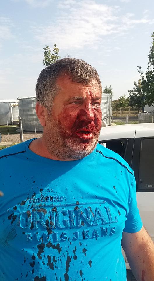 Un antrenor a fost umplut de sânge de rudele unui fotbalist. Imagini horror