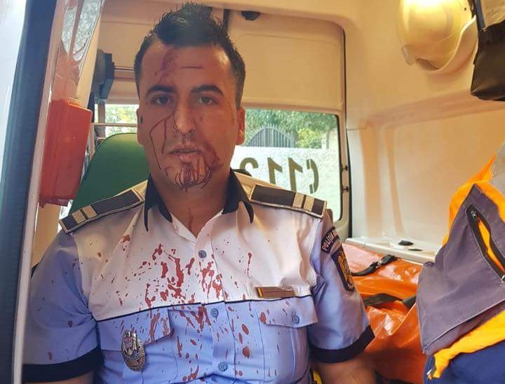 UPDATE. Polițist din Craiova, bătut cu telefonul mobil de un șofer pe care a încercat să-l rețină. Imagini șocante cu omul legii după agresiune