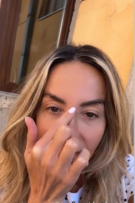 Flavia Mihășan după operația la nas