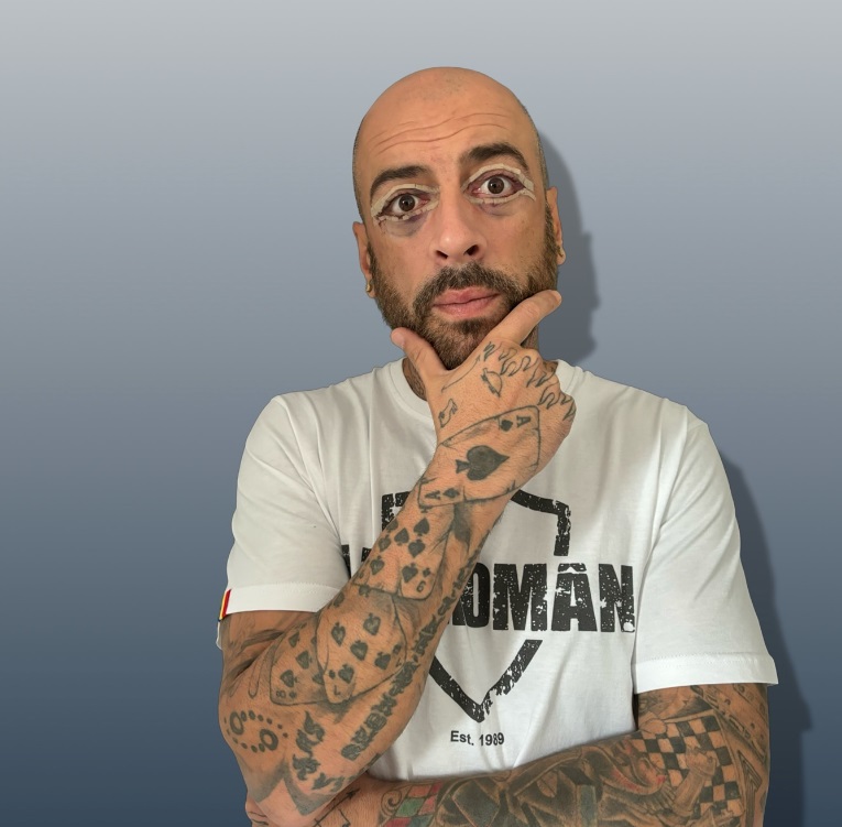Imagini cu CRBL după ce și-a făcut prima operație estetică la față. Fanii au reacționat: „În locul tău mi-aș face și un baby botox în frunte”