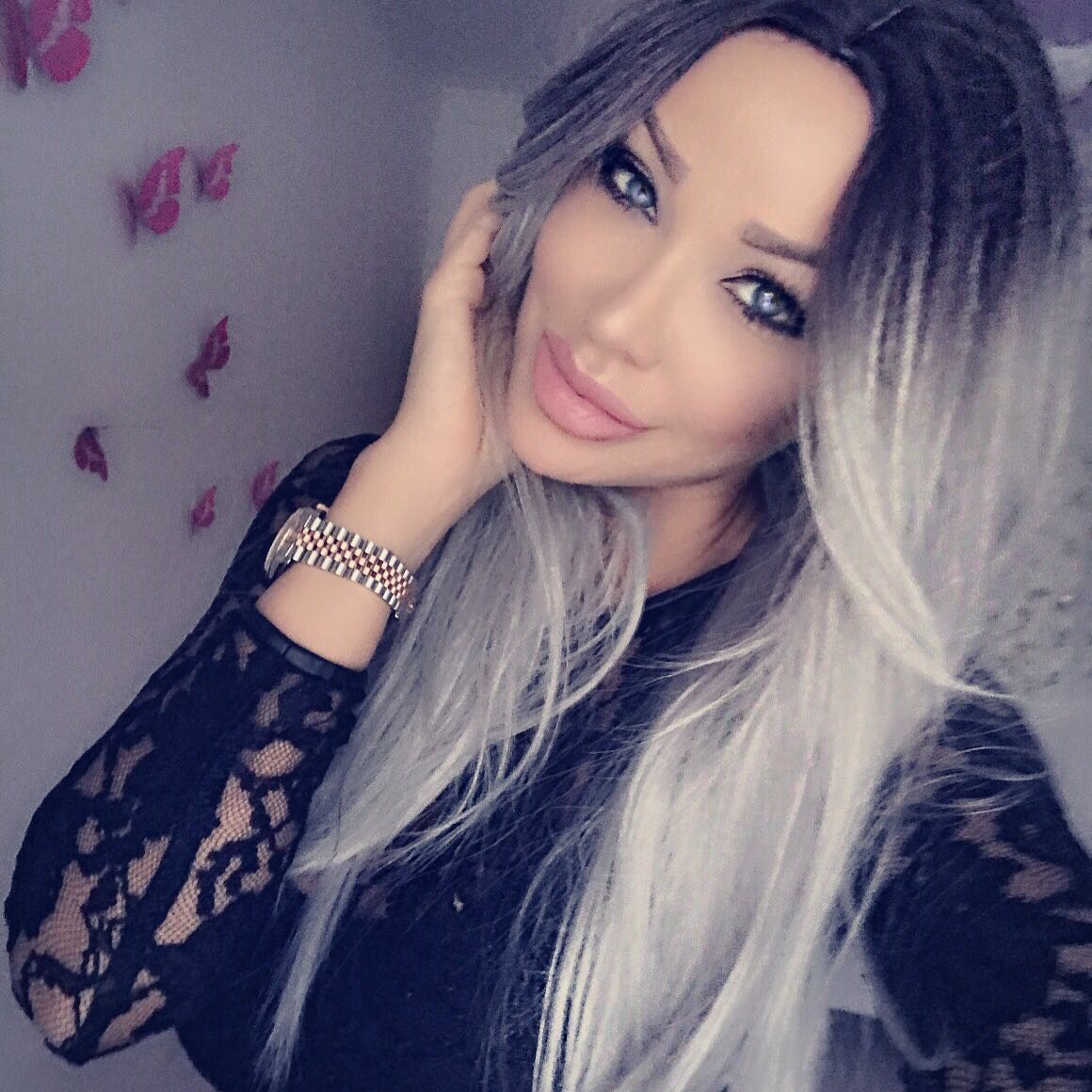 EXCLUSIV/ Bianca Drăgușanu se pregătește de o intervenție radicală. Își scoate sângele din scalp ca să-și salveze părul