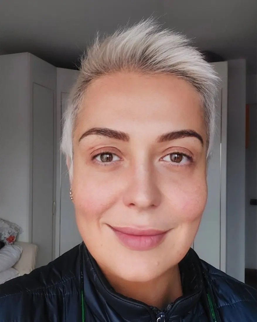 Ce intervenții estetice are Monica Anghel la față. Are 51 de ani: „Mereu stăteam încruntată. Acum m-am mai educat”