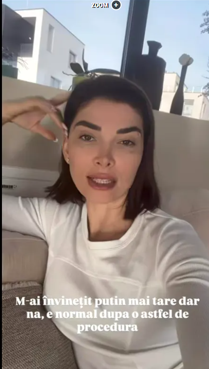 Reacția Alinei Pușcaș după ce a apărut cu vânătăi la ochi. Ce a pățit vedeta. „Mi-e un pic groază, pentru că doare”