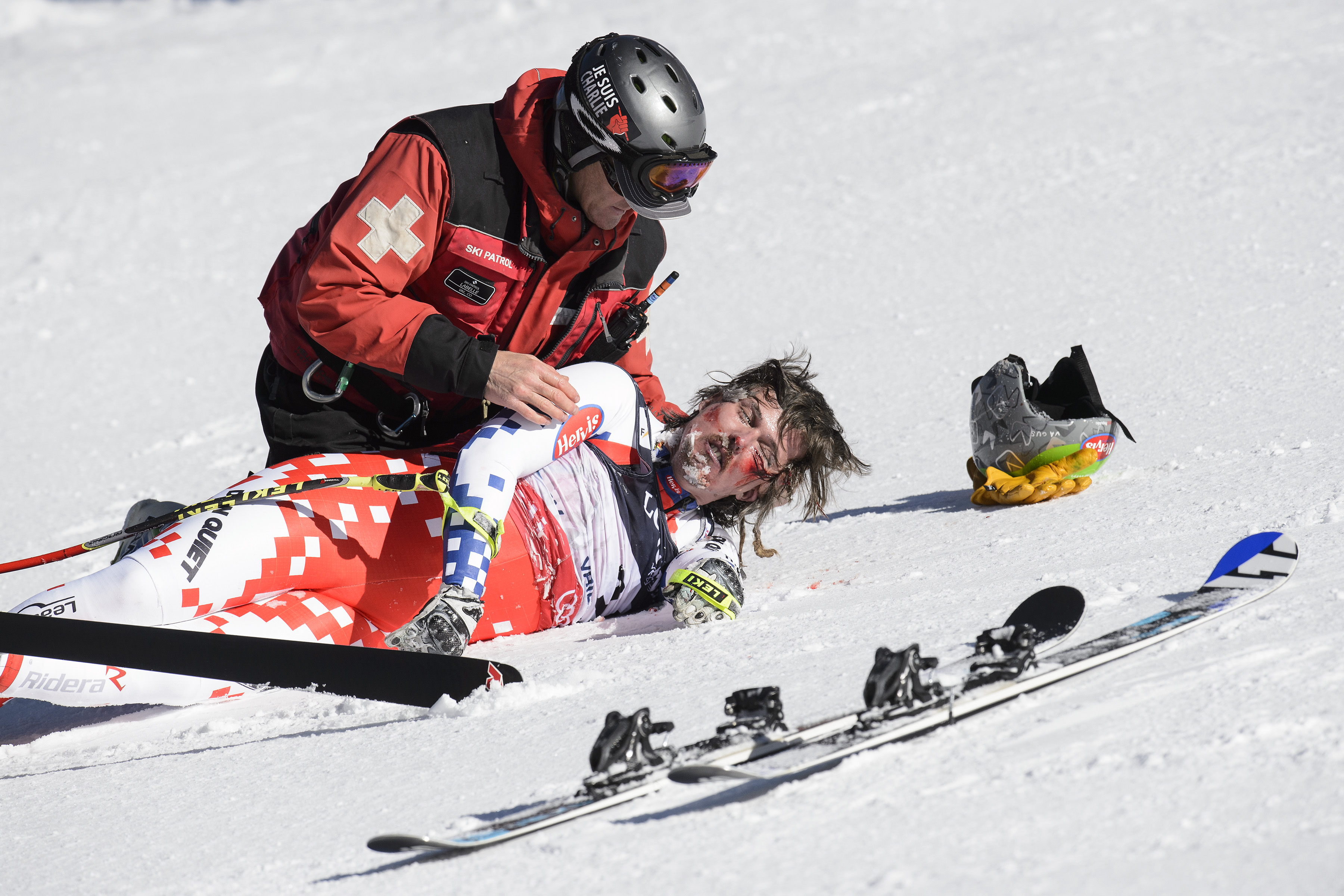 Schiorul Ondrej Bank, accidentare care l-a desfigurat / FOTO