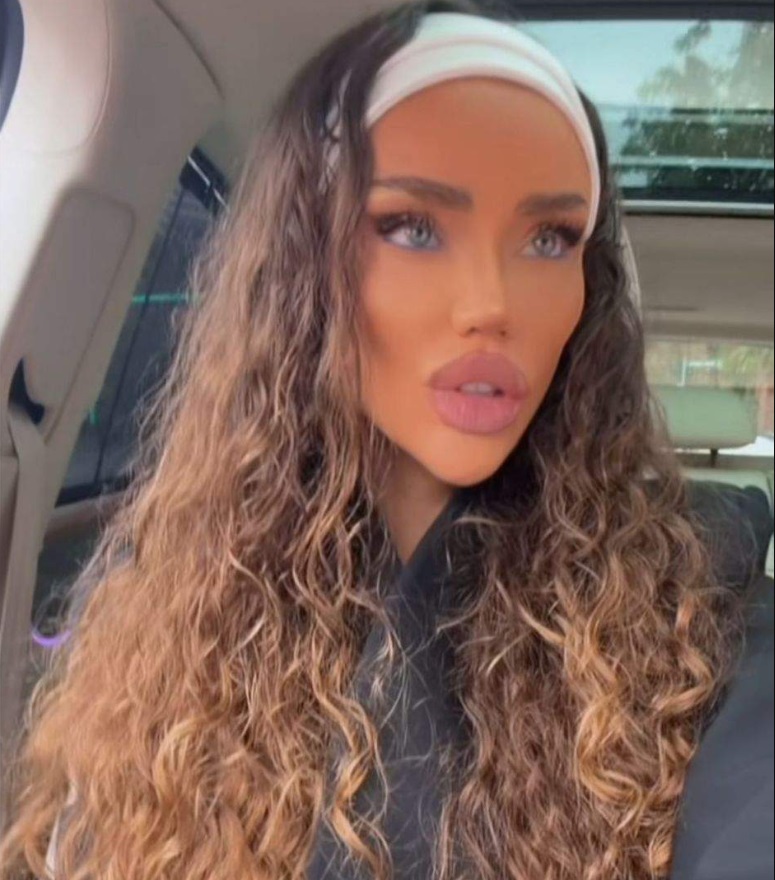 Operația estetică pe care Bianca Drăgușanu o va suferi: „Când mă uit la pozele cu mine, efectiv mi se pare că sunt foarte urâtă”