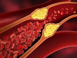 Cholestrol-