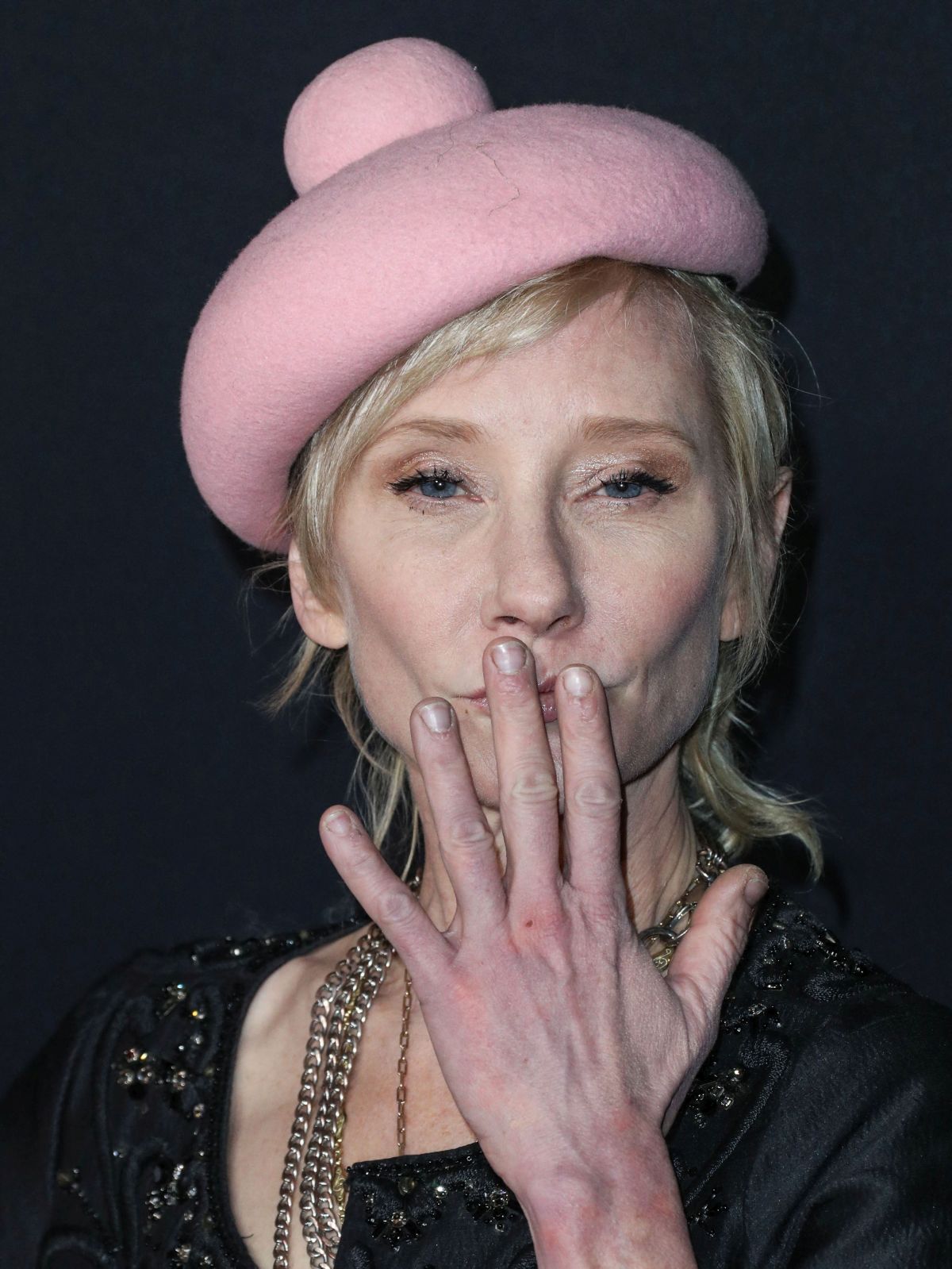Actrița Anne Heche a murit, la o săptămână după ce a intrat cu mașina într-o casă din Los Angeles