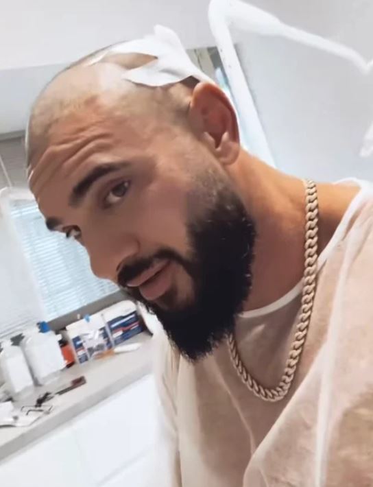 Dorian Popa, o nouă intervenție estetică: „Nu am capul umflat, nu am nicio problemă”