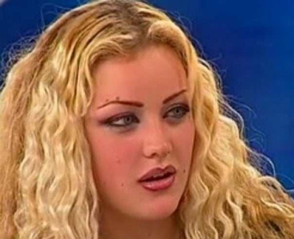 Vedetele din România care au apelat la medicul estetician. Cum arătau înainte de intervenții