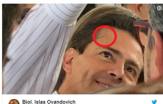 Președintele mexican a apărut în public cu o rană la cap. Ce i s-a întâmplat | FOTO