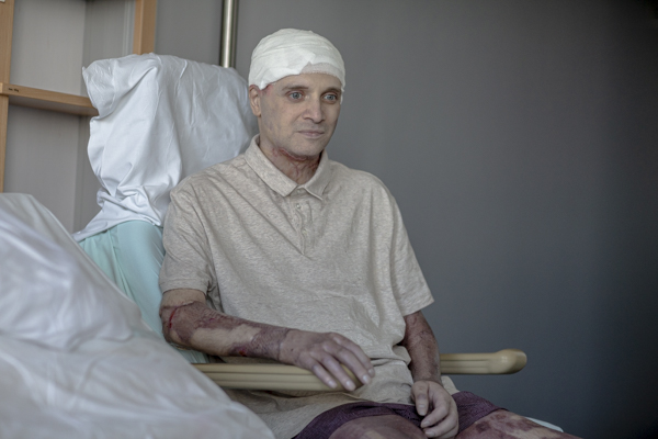 Primele imagini cu medicul-erou, după incendiul de la Piatra Neamț: „Astăzi pot să merg cu bicicleta”. Cătălin Denciu a început recuperarea