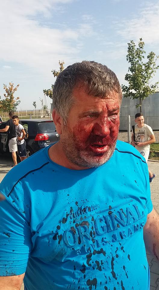 Un antrenor a fost umplut de sânge de rudele unui fotbalist. Imagini horror