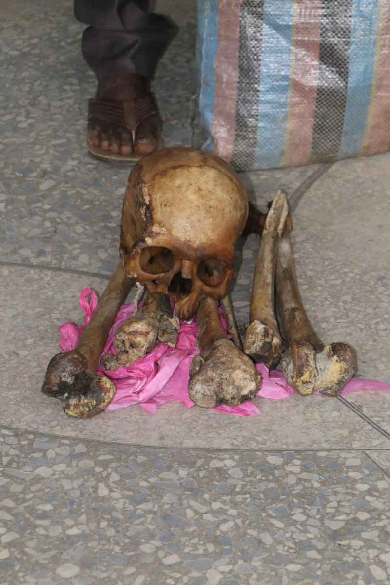 I planned to sell them for ?600k: Man caught with human parts confesses