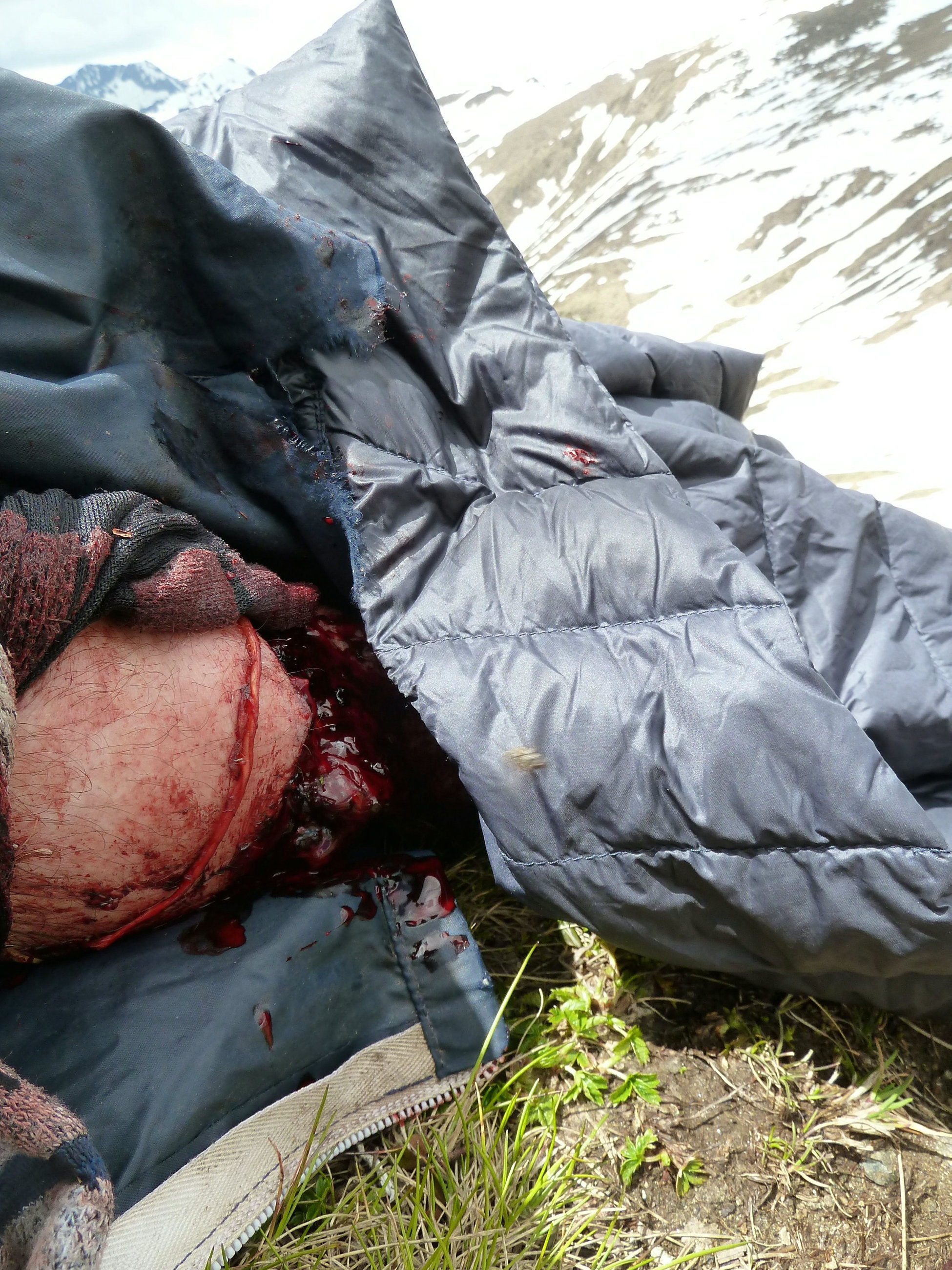 GALERIE FOTO | Cum i-a salvat o britanică viața iubitului ei atacat de un urs în România