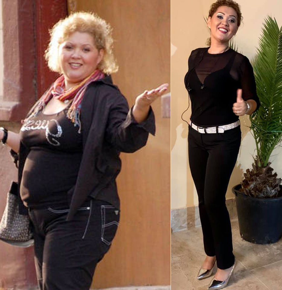 Minodora și-a făcut o nouă operație estetică: „Sunt tăiată după ureche. Totul e amorțit, doar usturime așa”. Artista nu se oprește aici cu intervențiile