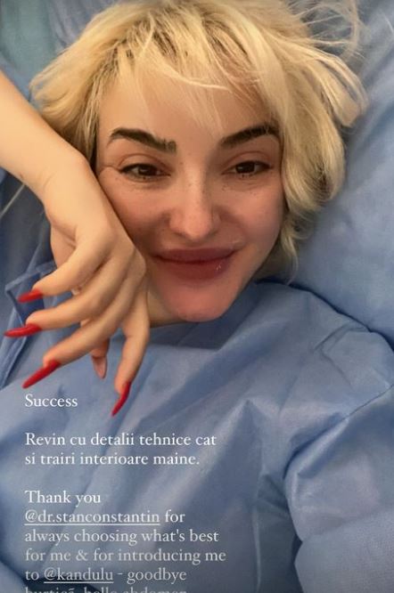 Ana Morodan, o nouă intervenție estetică: „Am abdomen, chiar lucrat și sculptat, am și nasul pe sus...”