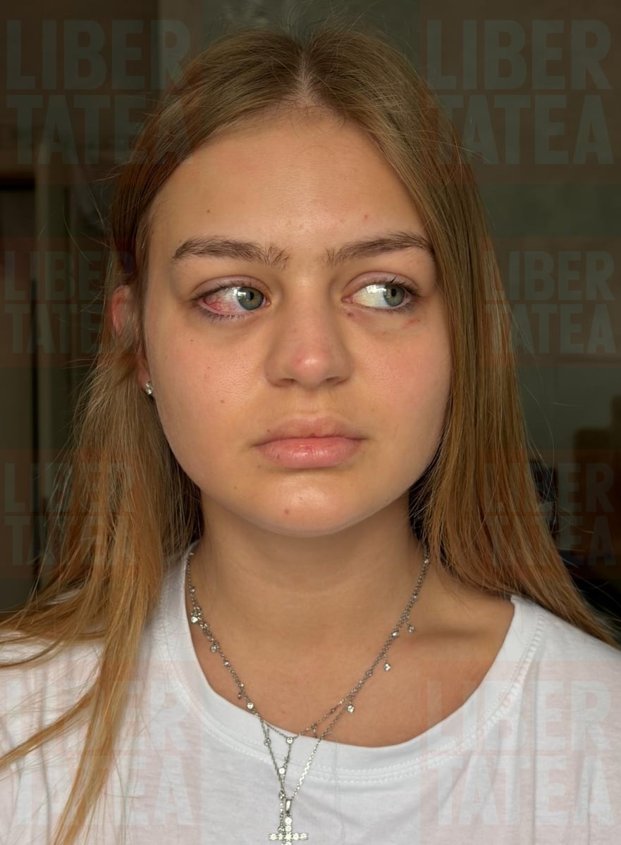 Cum arată Ana Beregoi după scandalul din restaurant cu Andreea Bostănică. Noi imagini: „Cine a sărit la bătaie”