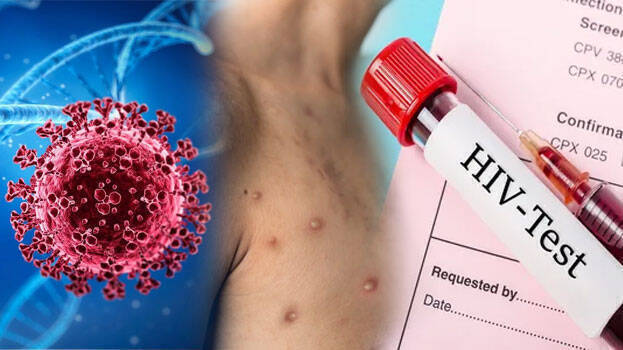 HIV/AIDS support to Africa survives U.S. spending cuts in last-minute reversal