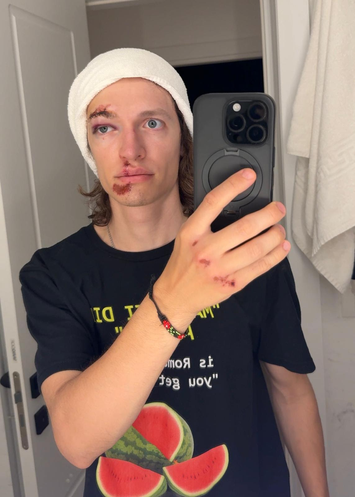 Ce a pățit un influencer venit din SUA după ce a mers cu trotineta prin București: „Noroc că eram în fața spitalului”