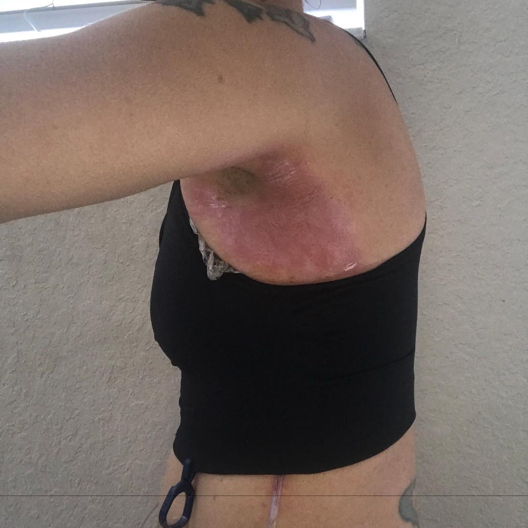 O mamă s-a ales cu o boală nouă după ce a făcut o operație "la modă" printre femei: "Dacă știam că poate provoca atâta durere, n-o mai făceam niciodată"