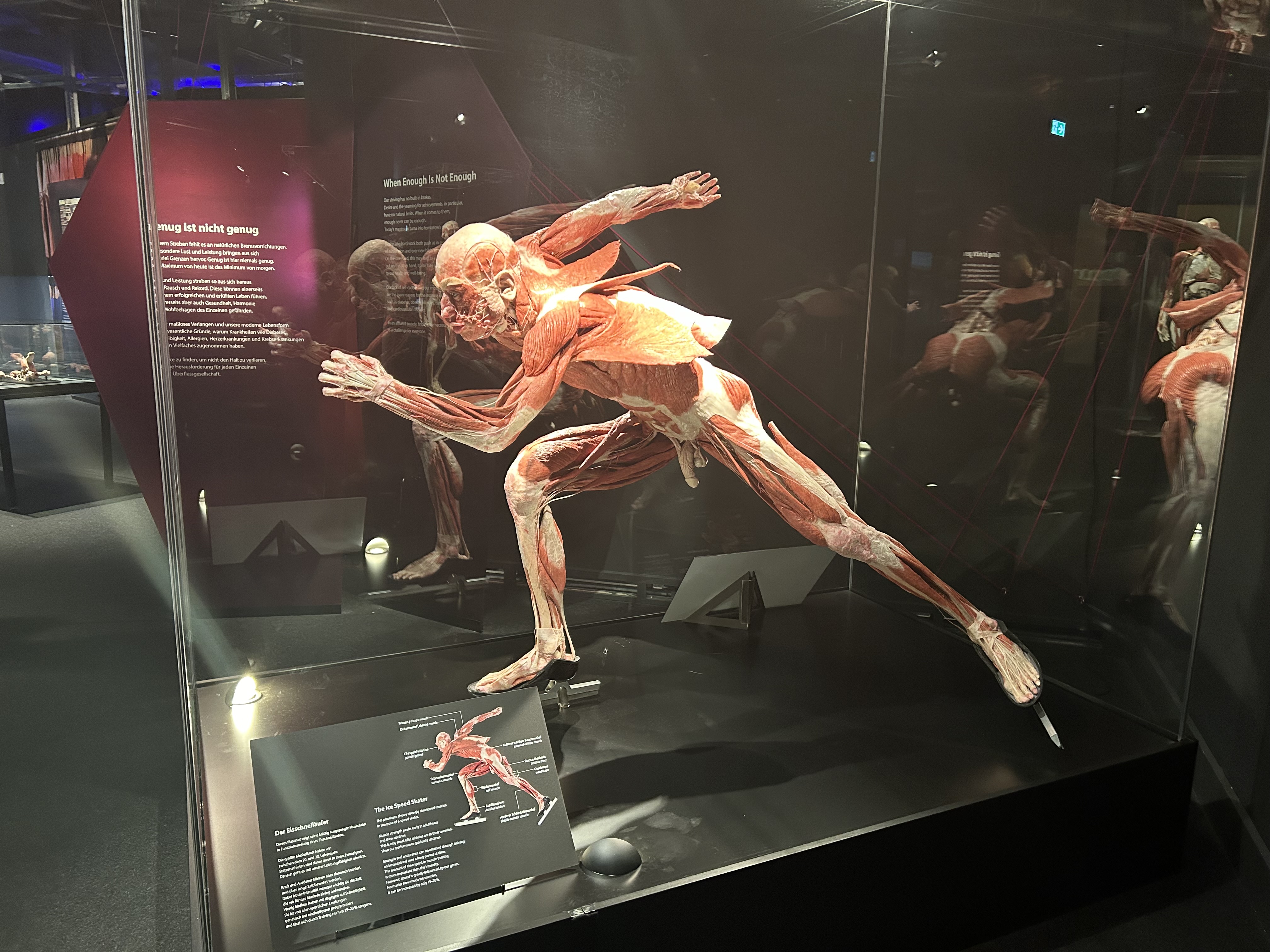 Tulburătoarea expoziție de „plastinate” organizată la București: „De fapt, totul este despre viață, nu despre moarte” | Interviu
