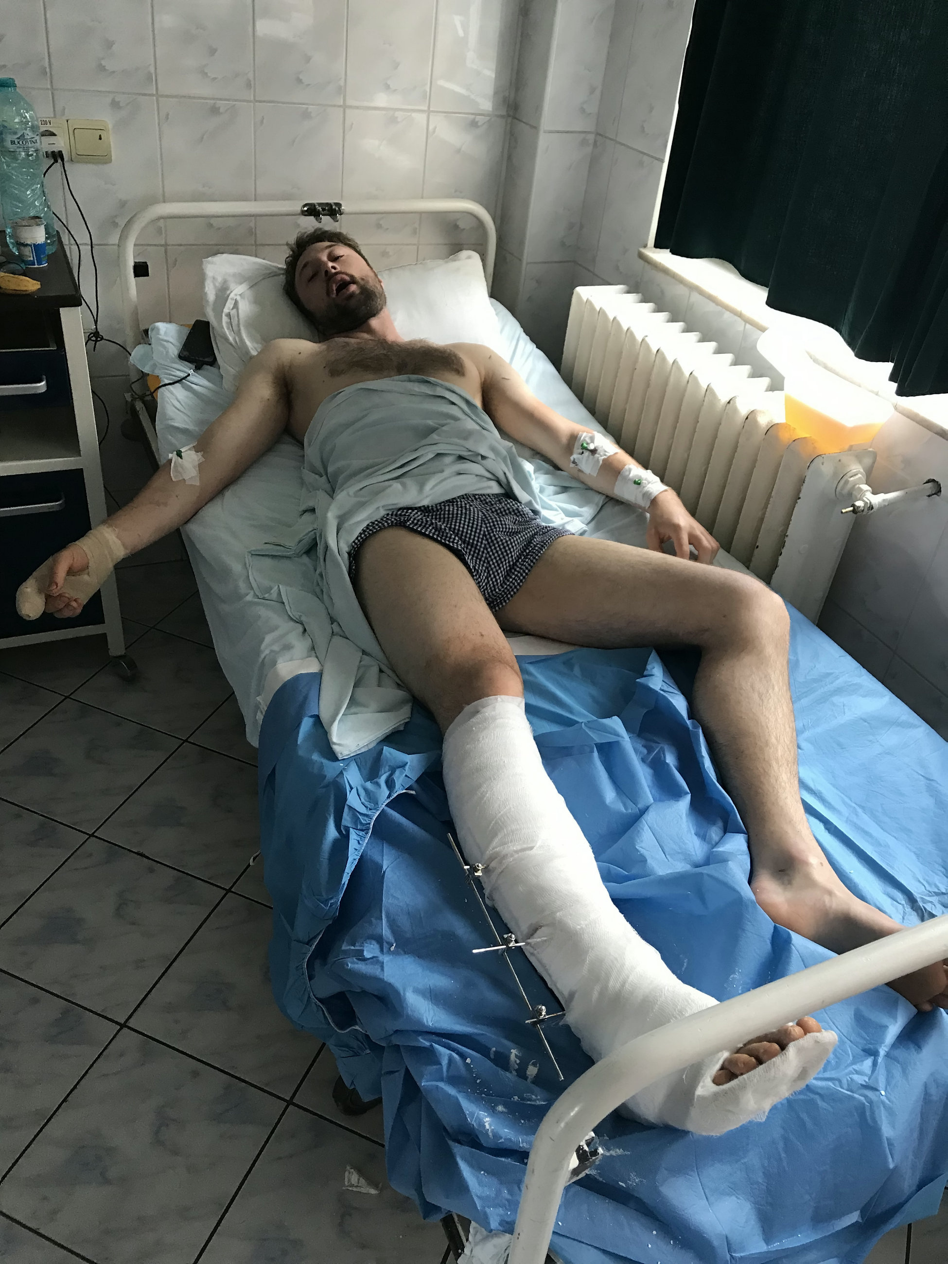 GALERIE FOTO | Cum i-a salvat o britanică viața iubitului ei atacat de un urs în România
