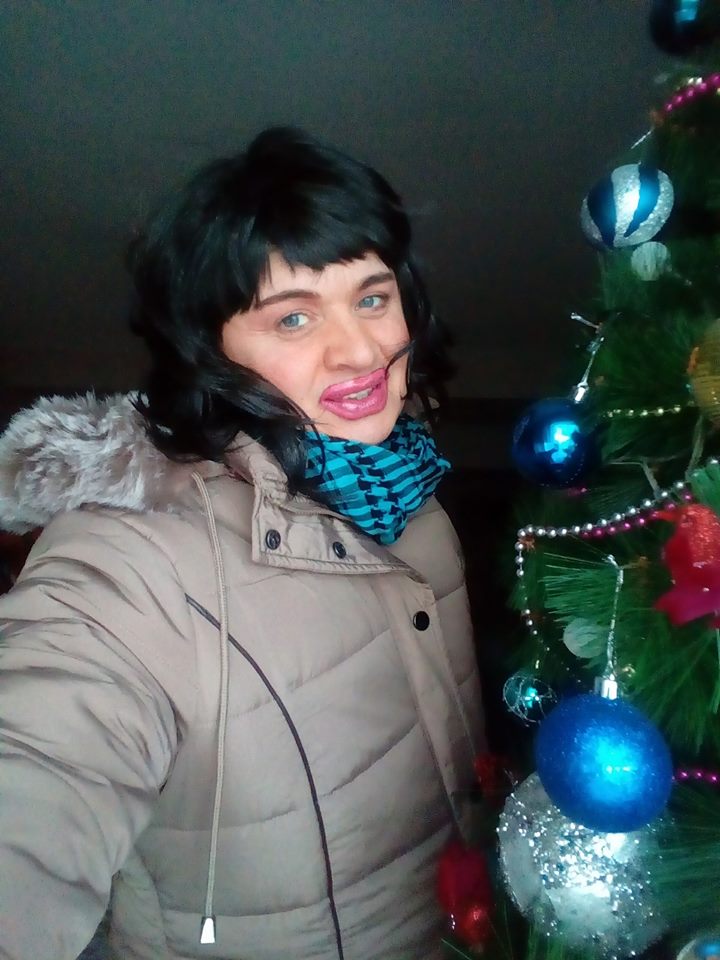 Halucinant cum poate să arate Cristi din Banat. "Mi-am pus silicon de sărbători, nu pot vorbi, nici nu pot mânca" | FOTO