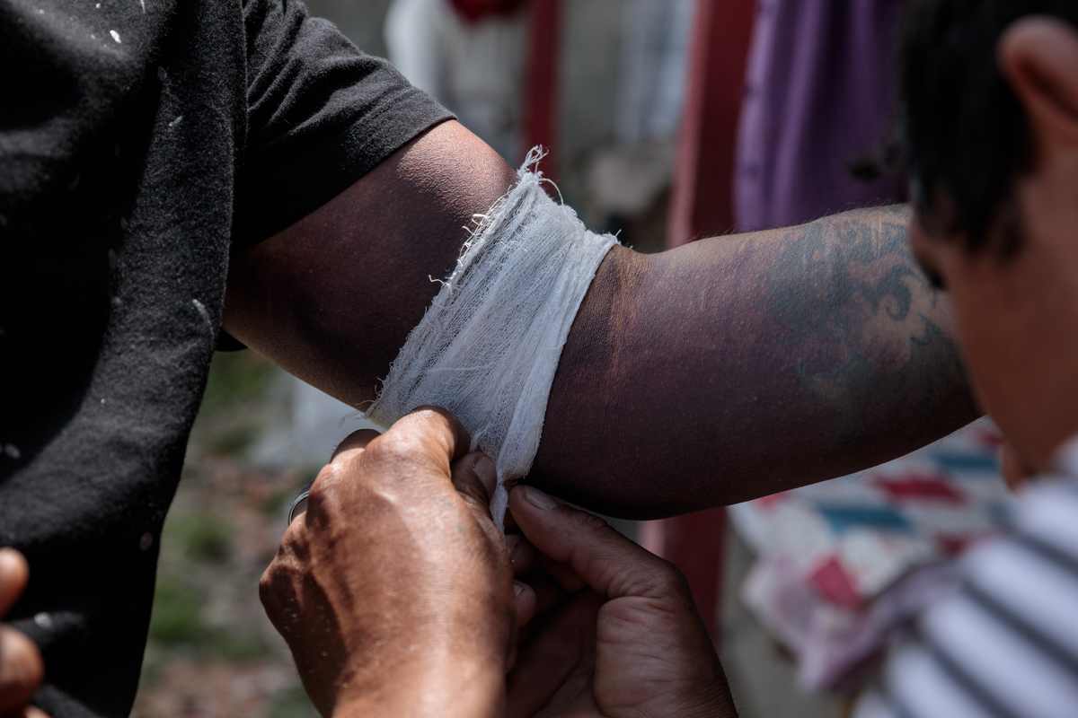 „M-au bătut până mi-a plesnit carnea”. Polițiștii dintr-o comună din Tulcea sunt acuzați de tortură, amenințări și umilințe
