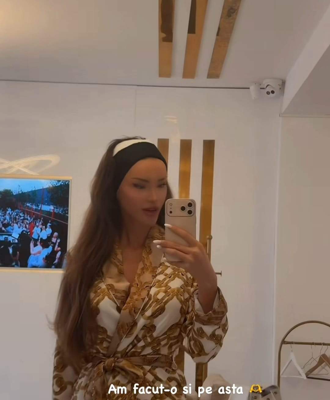 Imagini cu Bianca Drăgușanu după o nouă intervenție estetică. Are capul bandajat: „Am făcut-o și pe asta!”