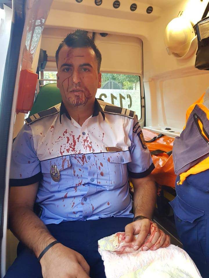 UPDATE. Polițist din Craiova, bătut cu telefonul mobil de un șofer pe care a încercat să-l rețină. Imagini șocante cu omul legii după agresiune