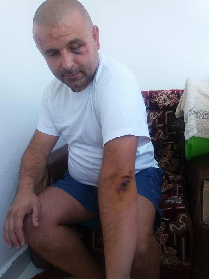 Un polițist din Piatra Neamț a fost bătut și lăsat fără încărcător. A primit pumni în cap pentru ca pistolul să nu ajungă la agresori