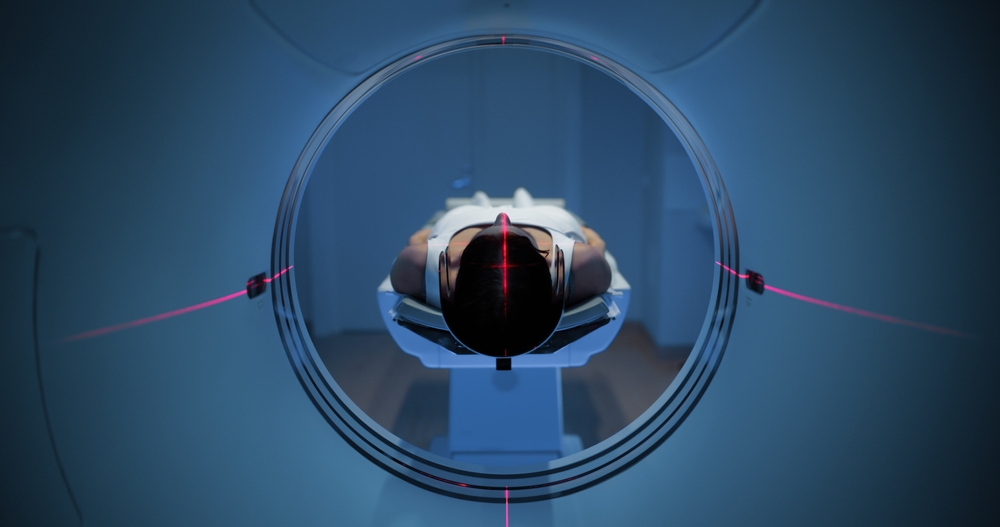 A tudósok egy rejtett „szennylefolyót” találtak az emberi agyban