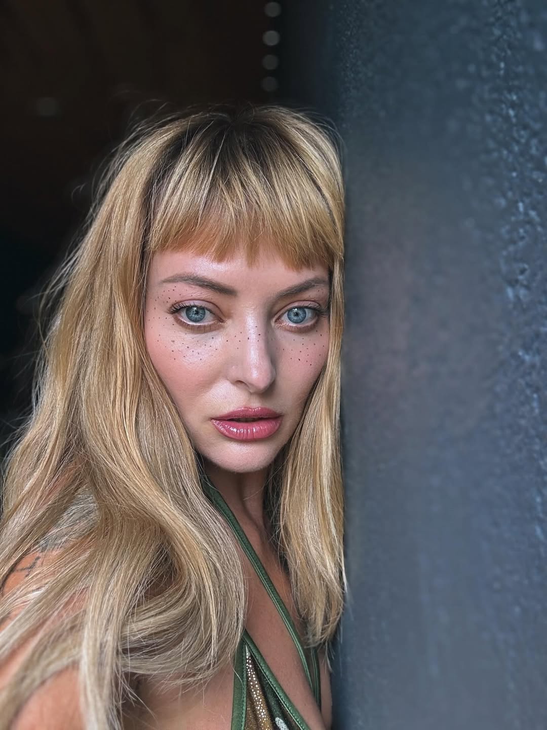 Problema pe care Delia Matache o are de la 16 ani. Le-a cerut ajutorul fanilor: „Am înțeles că e ceva extrem de ușor”