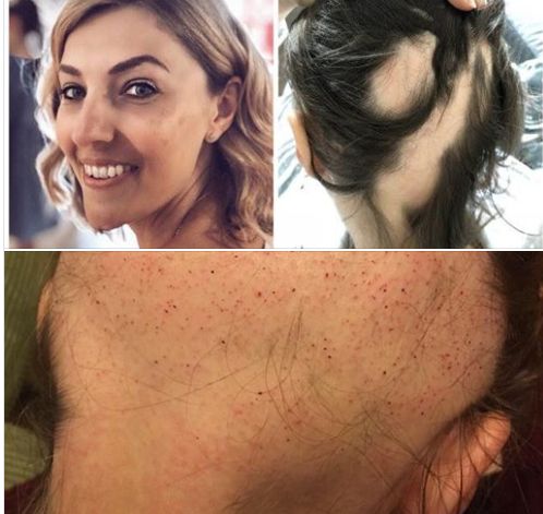A chelit din cauza stresului provocat de nuntă | FOTO