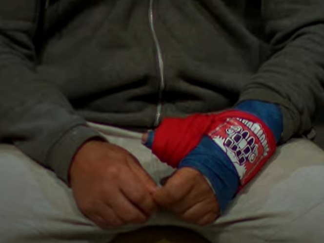 Ce se întâmplă cu Ionuț Iftimoaie după ce s-a accidentat grav la „Survivor România” 2023. Are mâna în ghips: „Sunt un luptător, dar este într-adevăr o problemă”